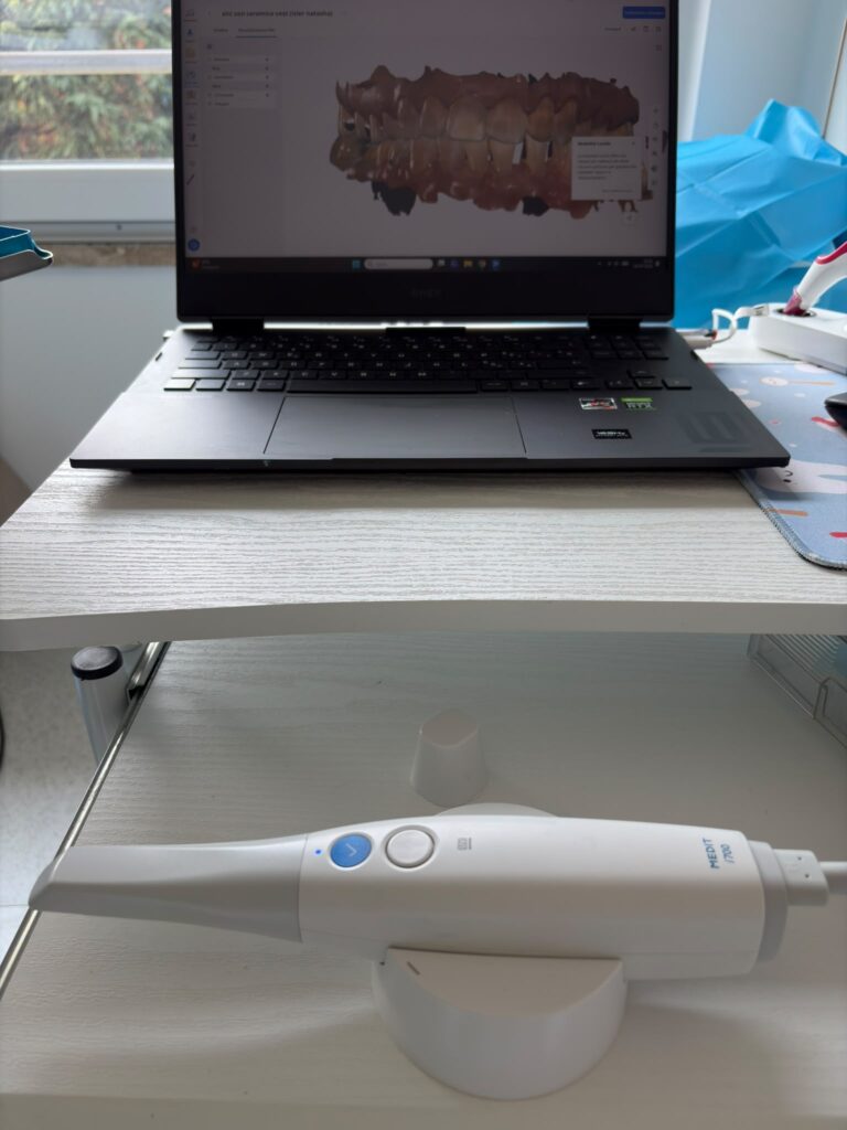 Check-up digitale: scansione 3D del cavo orale con scanner Medit