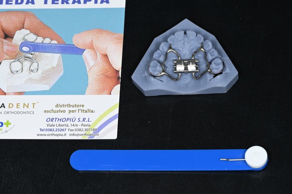 Ortodonzia intercettiva: apparecchio ortodontico con chiave di attivazione